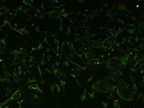 大鼠心肌成纤维细胞原代分离培养